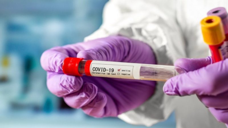 За вихідні на коронавірусну інфекцію захворіло ще 30 вінничан