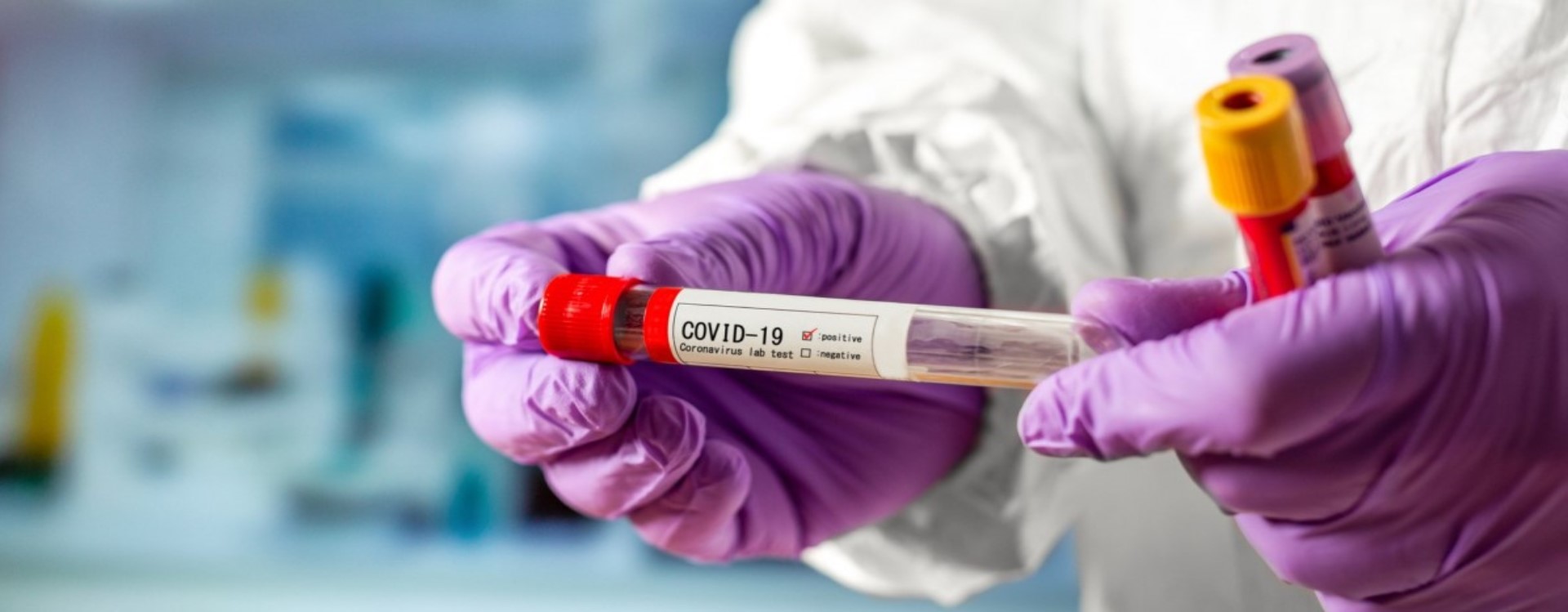 За вихідні на коронавірусну інфекцію захворіло ще 30 вінничан