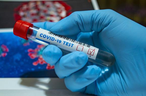 У Вінниці вперше виявили коронавірус у понад ста людей
