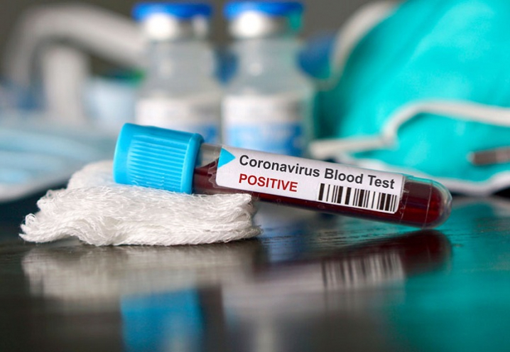В області за добу від коронавірусу померло 3 людини