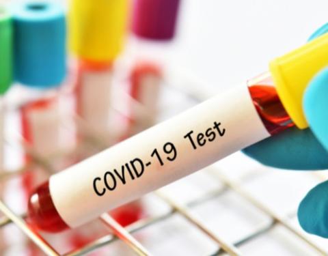 COVID-19: на Вінниччині зафіксовано 17 нових випадків захворювання