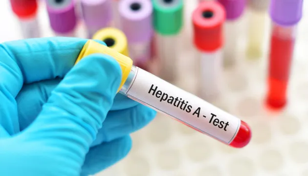 Як вберегтись від гепатиту А – поради лікарів вінничанам