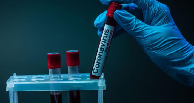Понад три тисячі вінничан хворіють на коронавірус