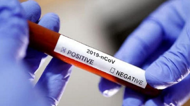 Ситуація з коронавірусом в першу добу 2021 +66 нових хворих