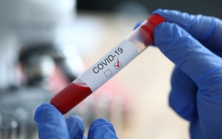 COVID-19: на Вінниччині зареєстровано 35 нових випадків