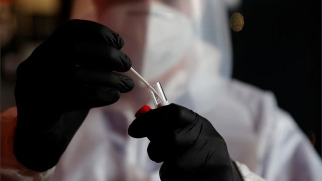 На Вінниччині зафіксовано 76 нових випадків коронавірусу