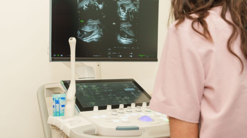 Перша партія медичного обладнання, придбаного за допомоги Тайваню, прибула до Центру матері та дитини